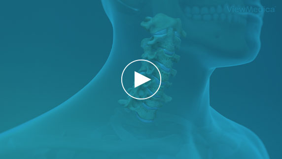 Spinal Fusion & Cervical Spine Specialist | Dr John Cunningham